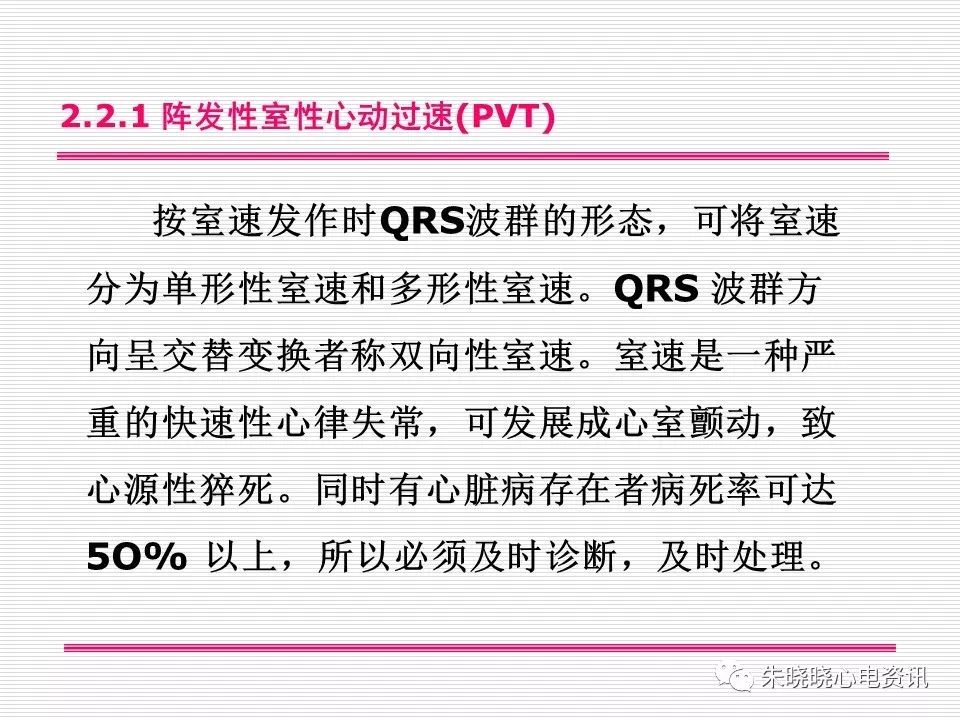 心电图危急值识别与诊断，看完我就收藏了！