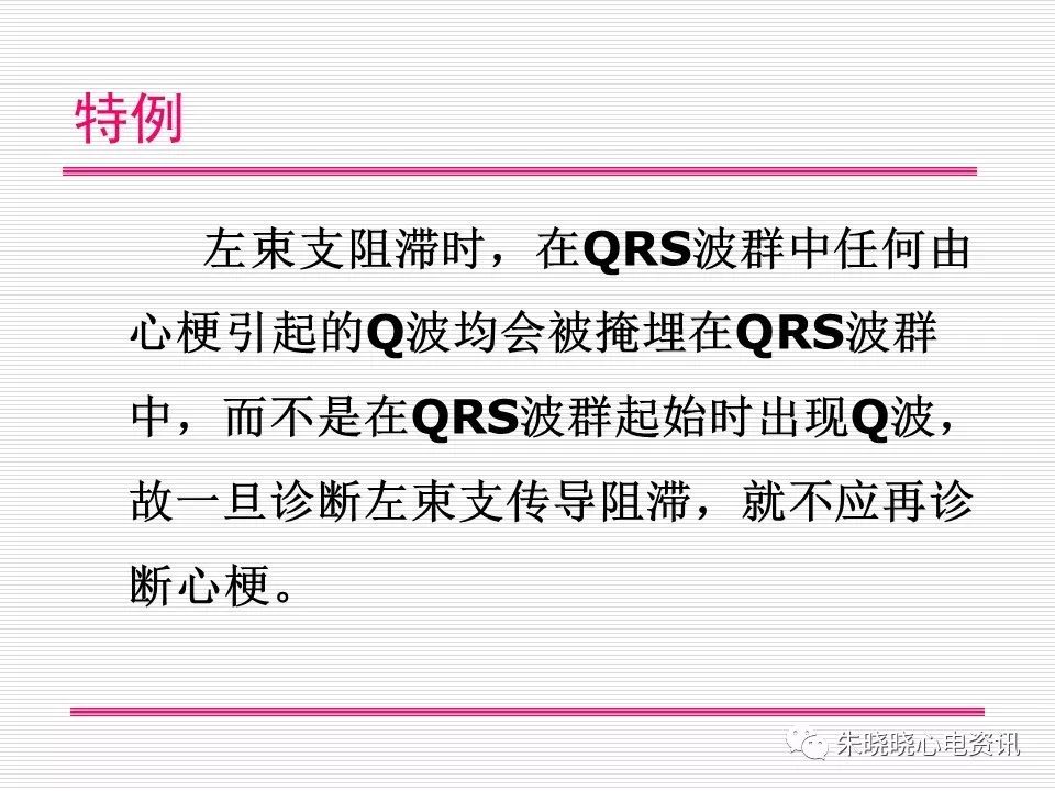 心电图危急值识别与诊断，看完我就收藏了！