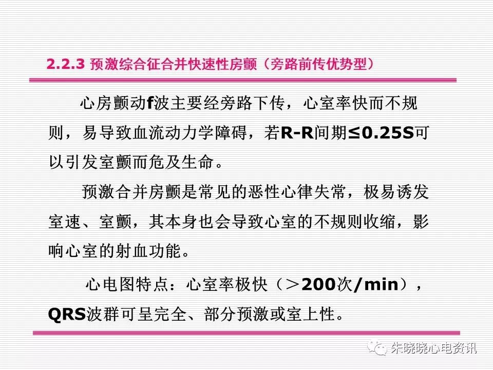 心电图危急值识别与诊断，看完我就收藏了！