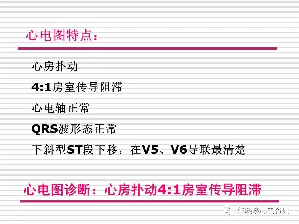 心电图危急值识别与诊断，看完我就收藏了！