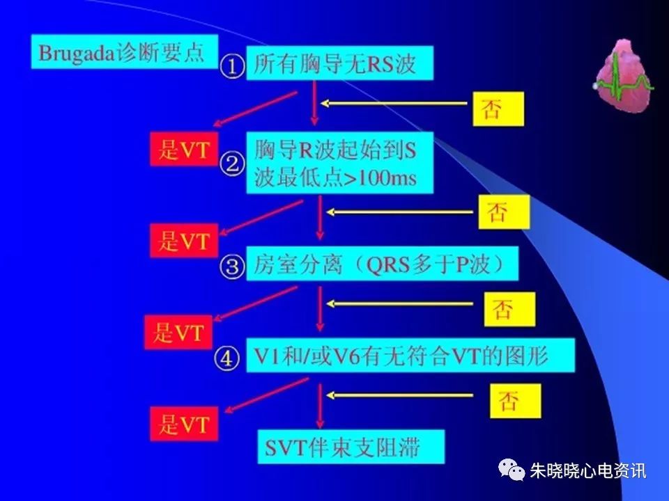 特殊心电图现象在急诊中的快速识别与处理，赶紧收藏！