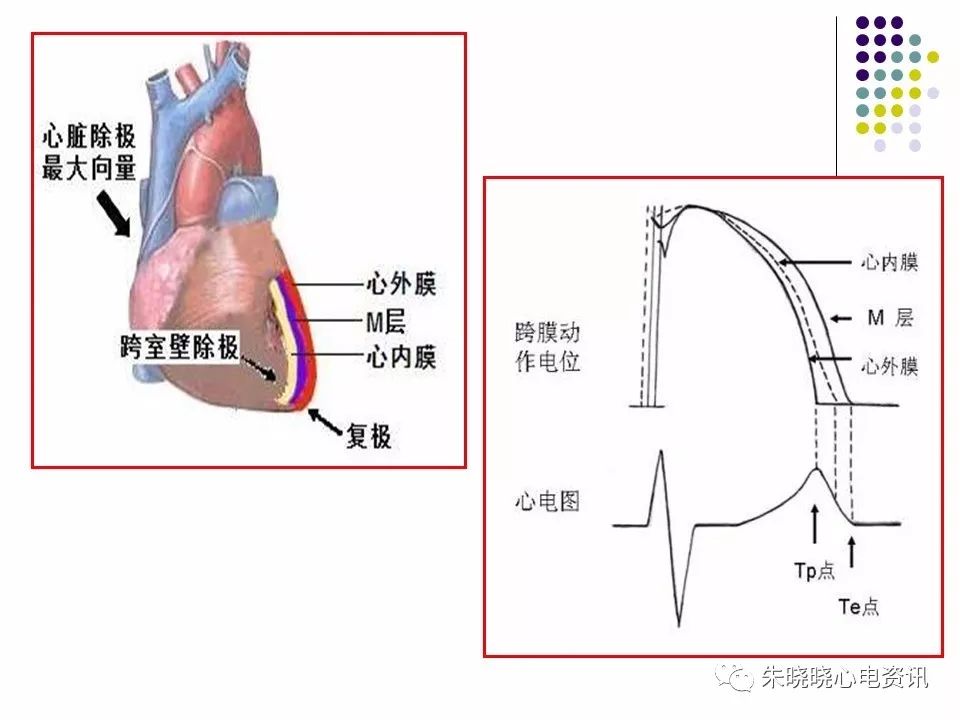 特殊心电图现象在急诊中的快速识别与处理，赶紧收藏！