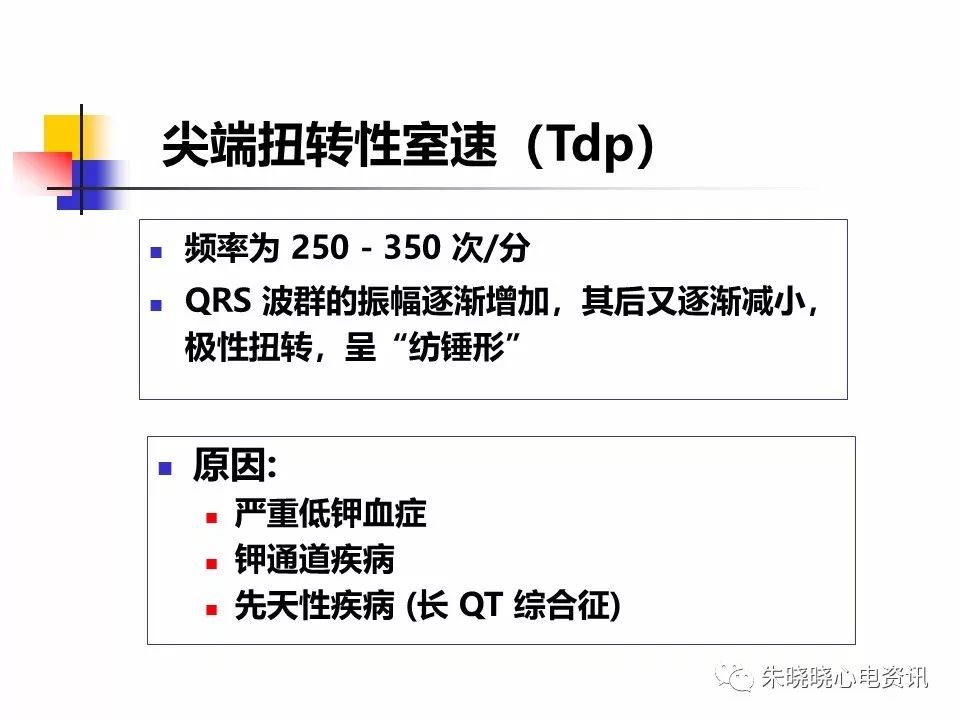 特殊心电图现象在急诊中的快速识别与处理，赶紧收藏！