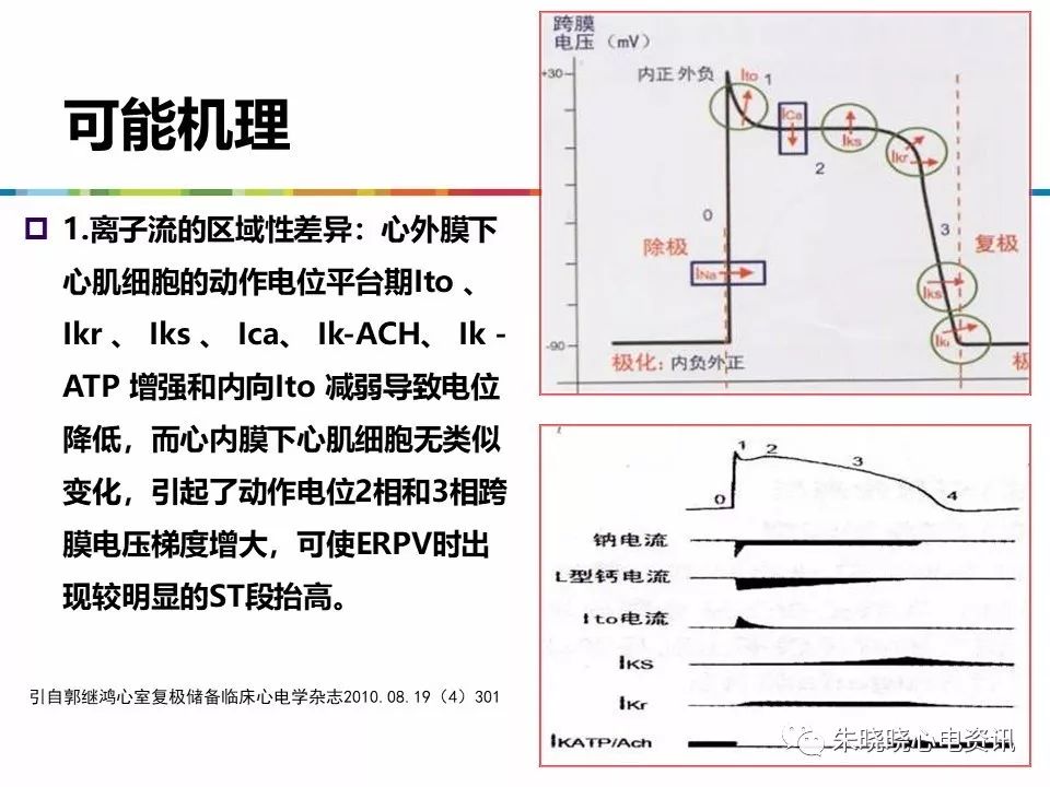 特殊心电图现象在急诊中的快速识别与处理，赶紧收藏！