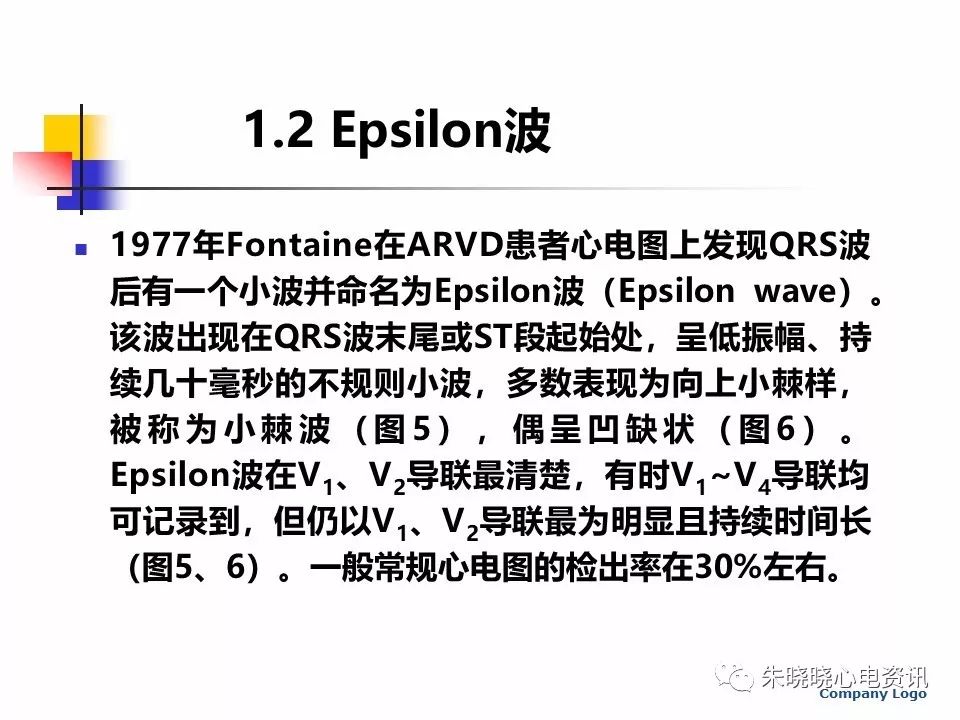 特殊心电图现象在急诊中的快速识别与处理，赶紧收藏！