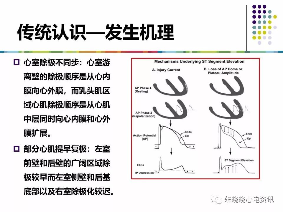 特殊心电图现象在急诊中的快速识别与处理，赶紧收藏！