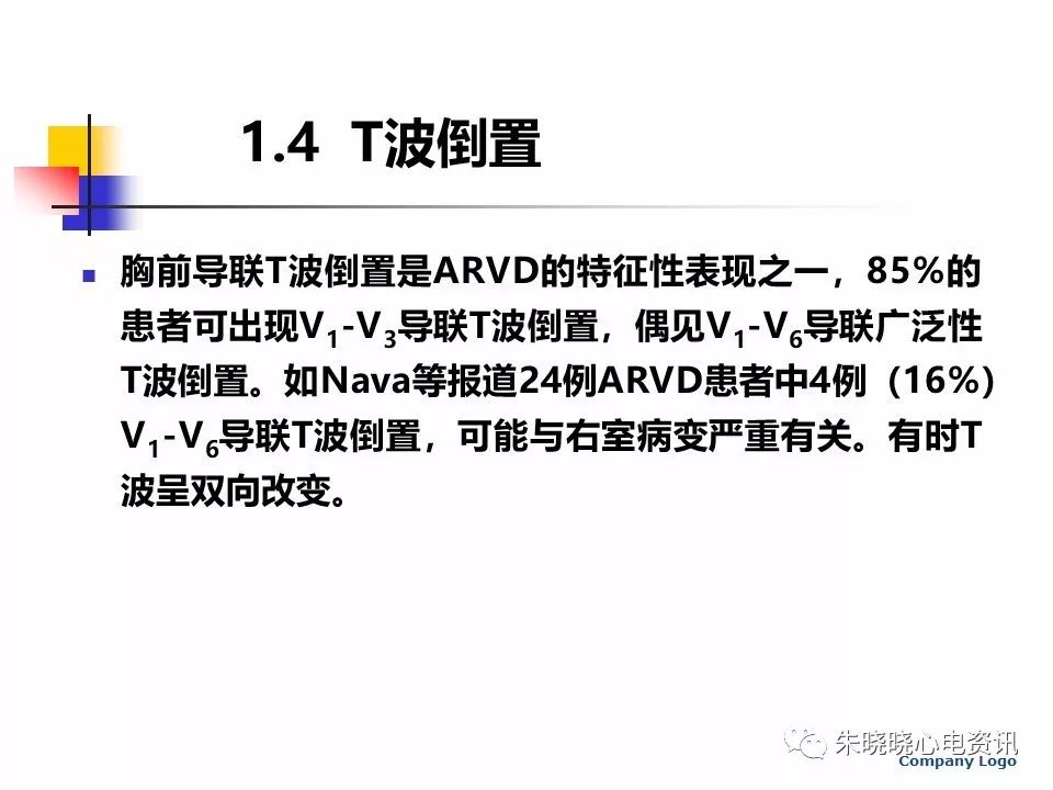 特殊心电图现象在急诊中的快速识别与处理，赶紧收藏！