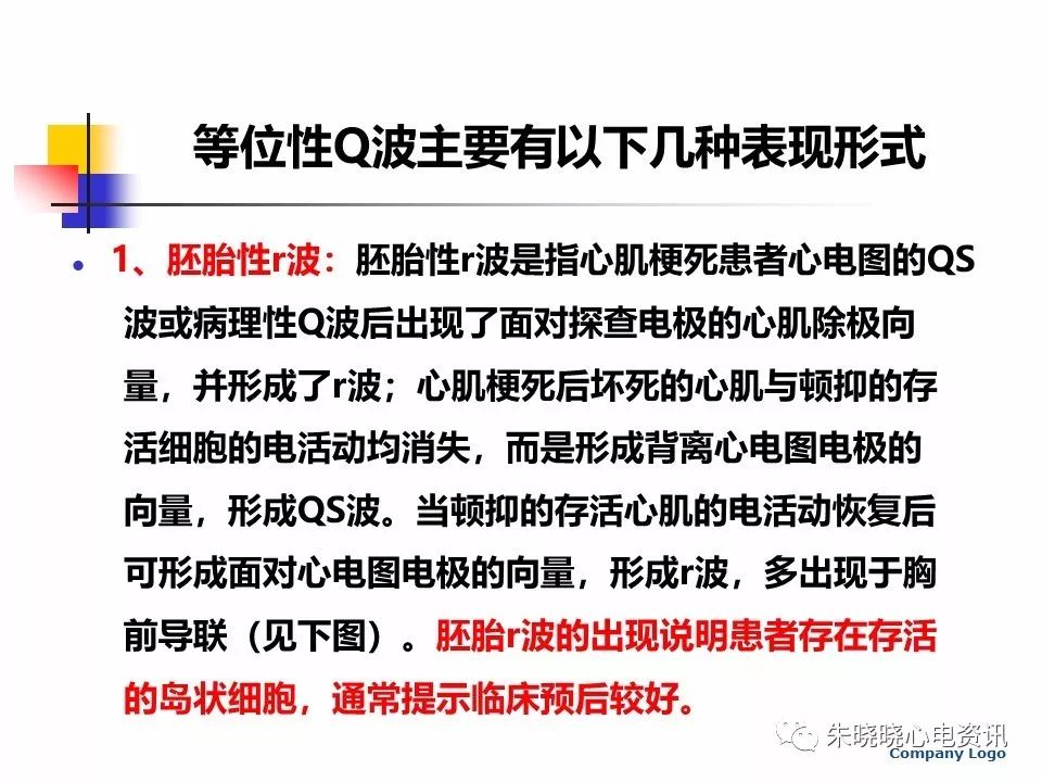 特殊心电图现象在急诊中的快速识别与处理，赶紧收藏！