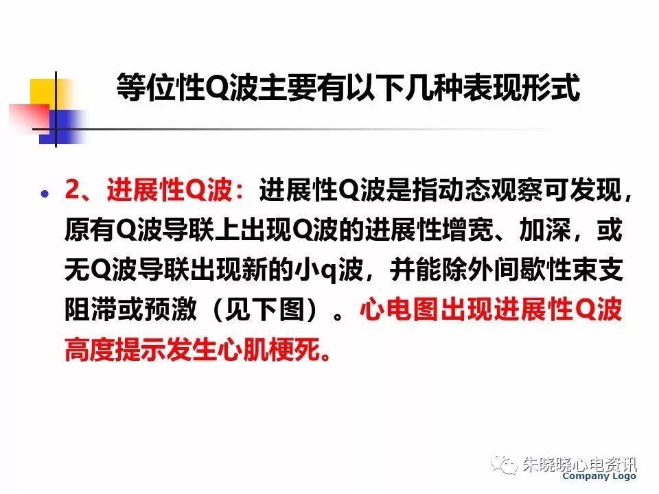 特殊心电图现象在急诊中的快速识别与处理，赶紧收藏！