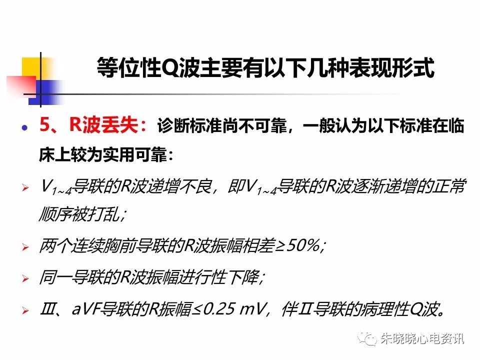 特殊心电图现象在急诊中的快速识别与处理，赶紧收藏！