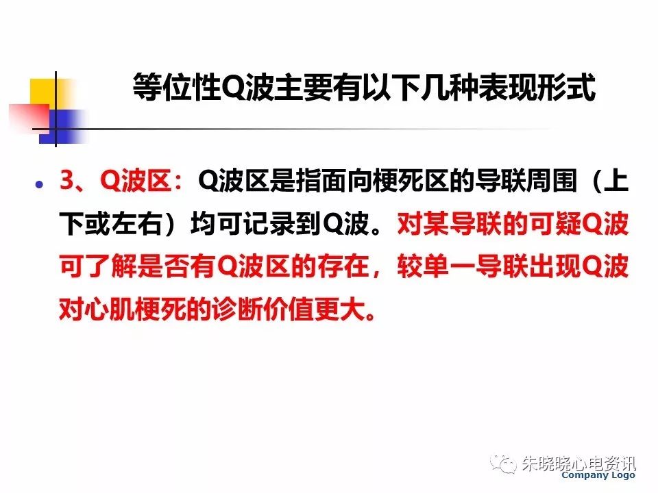 特殊心电图现象在急诊中的快速识别与处理，赶紧收藏！