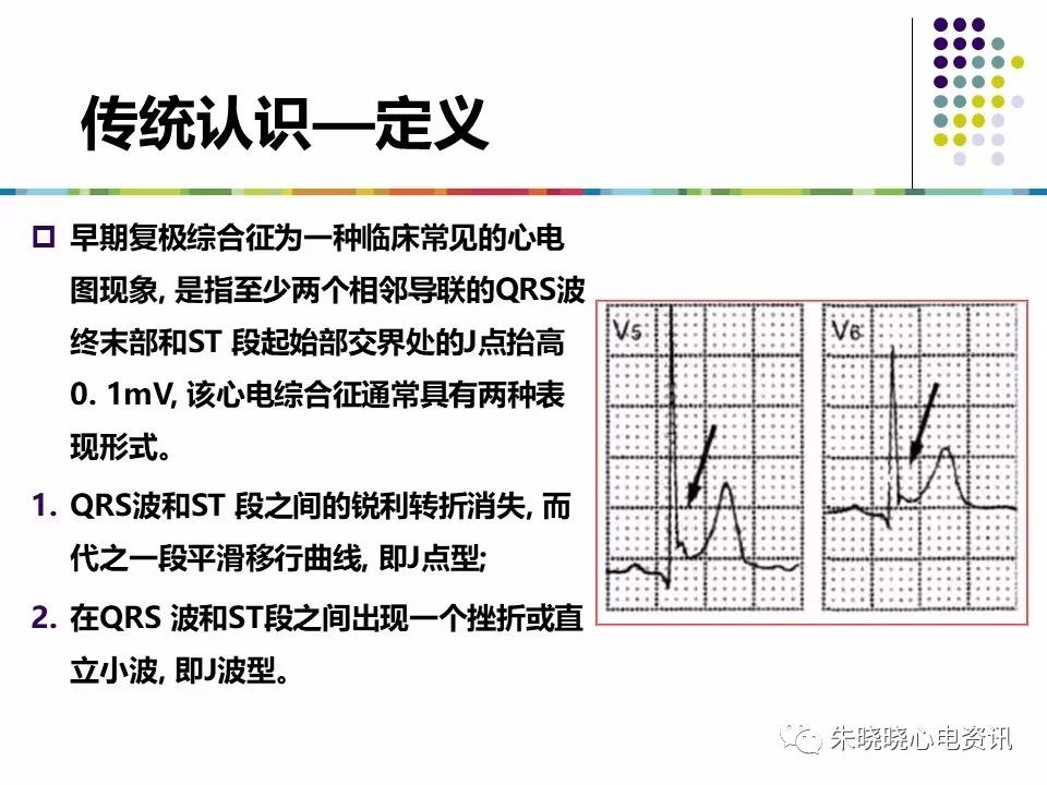 特殊心电图现象在急诊中的快速识别与处理，赶紧收藏！