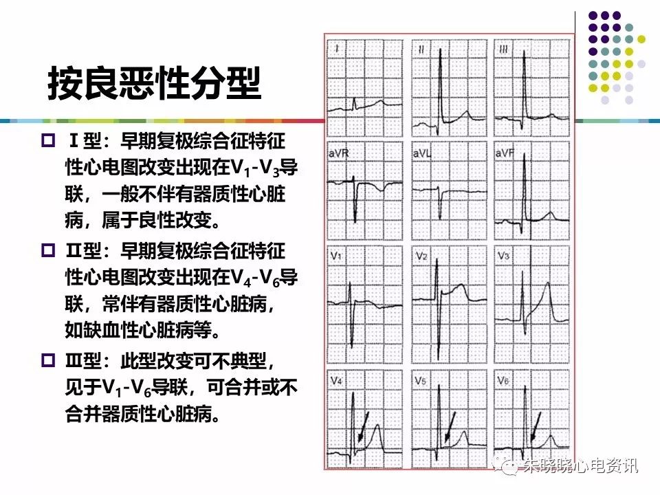 特殊心电图现象在急诊中的快速识别与处理，赶紧收藏！