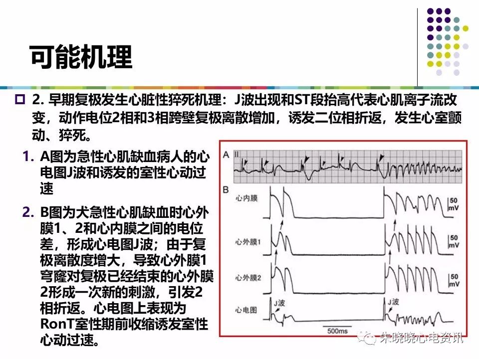 特殊心电图现象在急诊中的快速识别与处理，赶紧收藏！