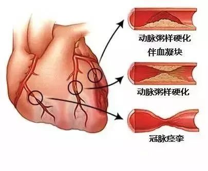 心血管系统及疾病图解大合集，值得收藏！