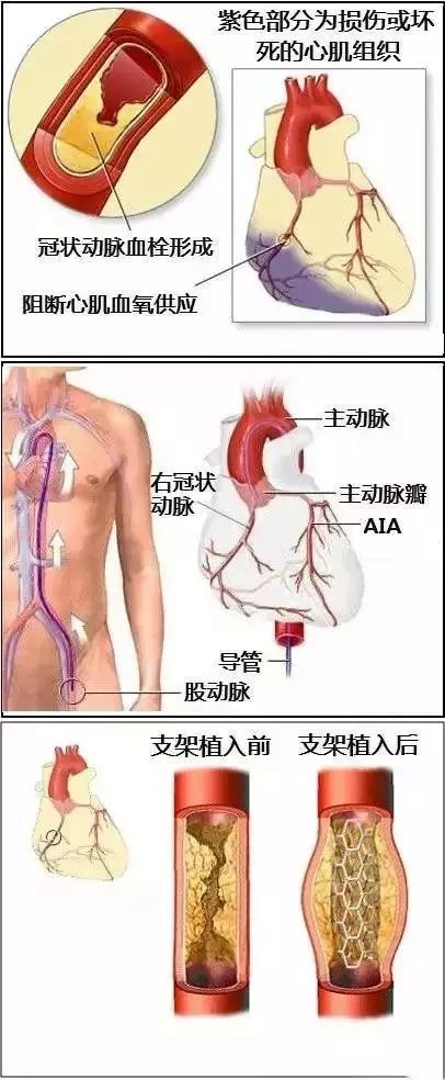 心血管系统及疾病图解大合集，值得收藏！