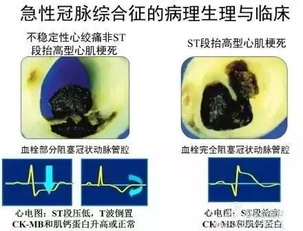 心血管系统及疾病图解大合集，值得收藏！