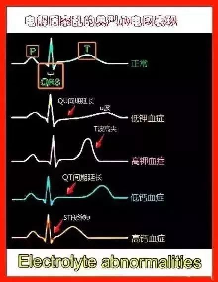 心血管系统及疾病图解大合集，值得收藏！