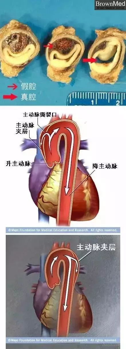 心血管系统及疾病图解大合集，值得收藏！