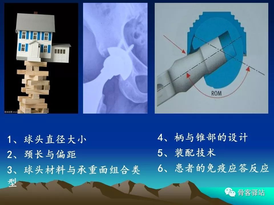 如何延长人工髋关节的使用寿命？本文值得一看！