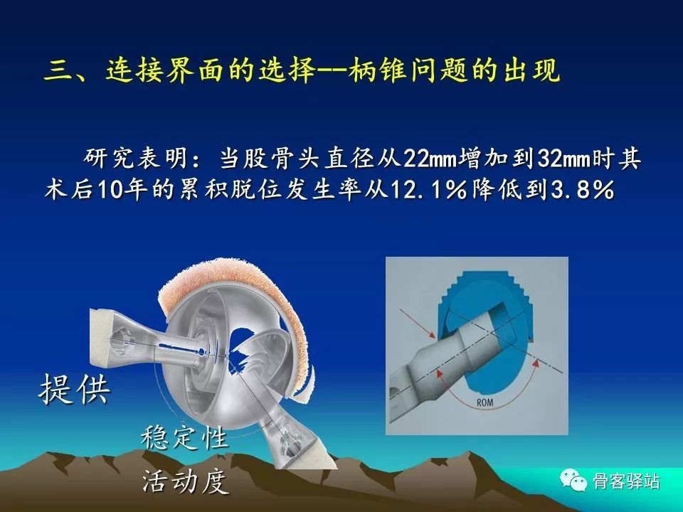 如何延长人工髋关节的使用寿命？本文值得一看！