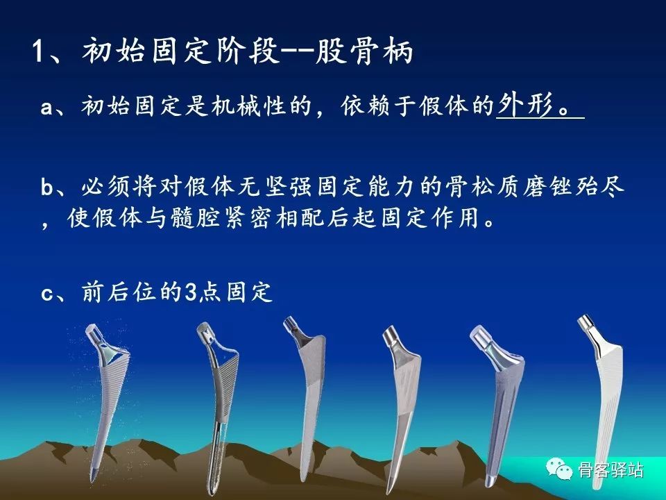 如何延长人工髋关节的使用寿命？本文值得一看！