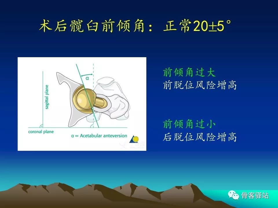 一文详解：全髋关节置换术后的X线评估