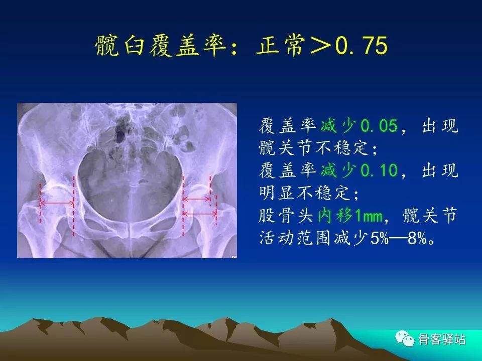 一文详解：全髋关节置换术后的X线评估