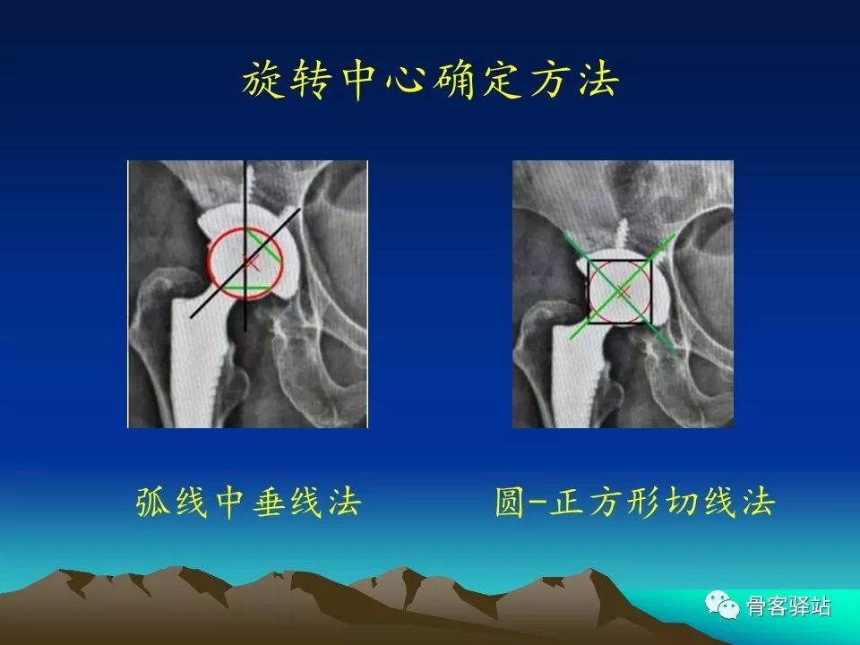 一文详解：全髋关节置换术后的X线评估