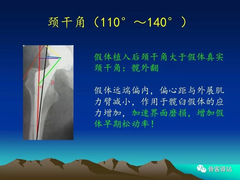 一文详解：全髋关节置换术后的X线评估