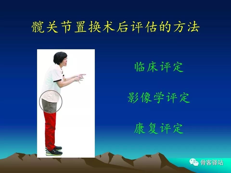 一文详解：全髋关节置换术后的X线评估