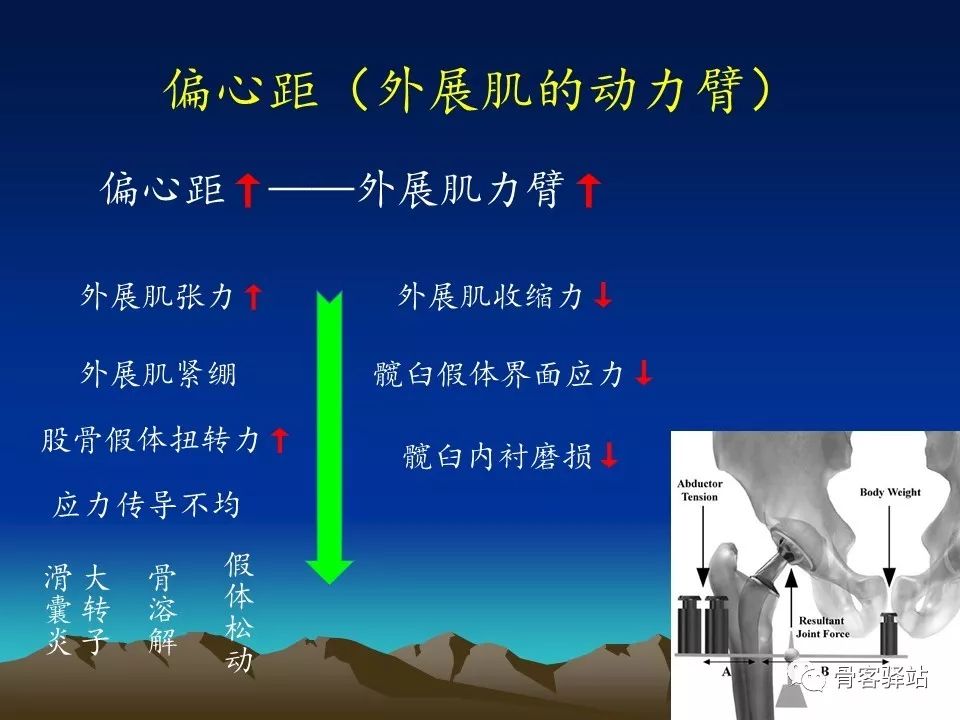 一文详解：全髋关节置换术后的X线评估