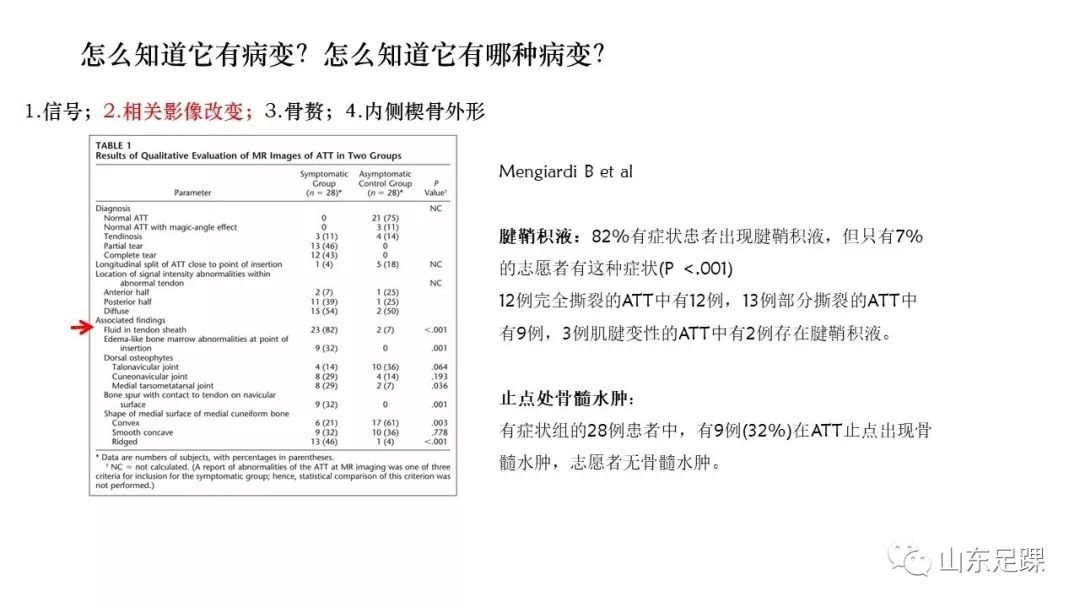 胫前肌腱病变的诊治，值得一看！