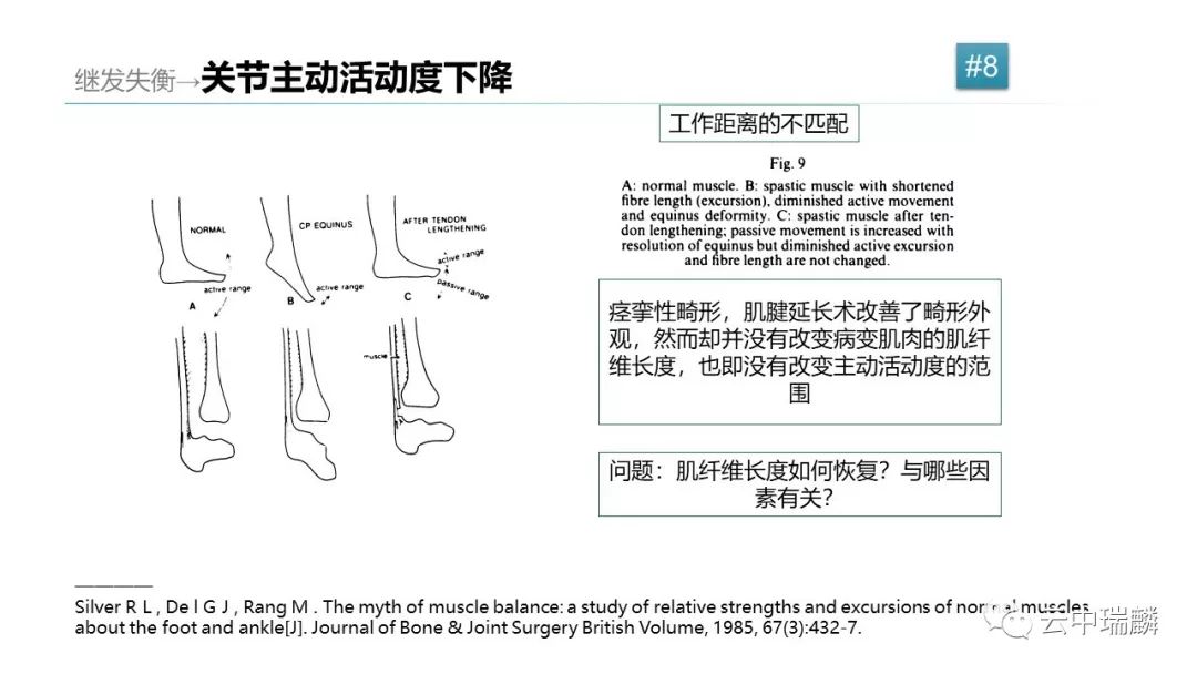 肌腱转位的原则及手术要点，详细解析！