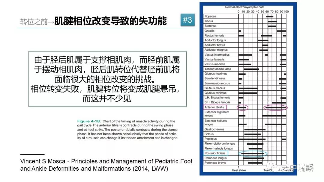 肌腱转位的原则及手术要点，详细解析！