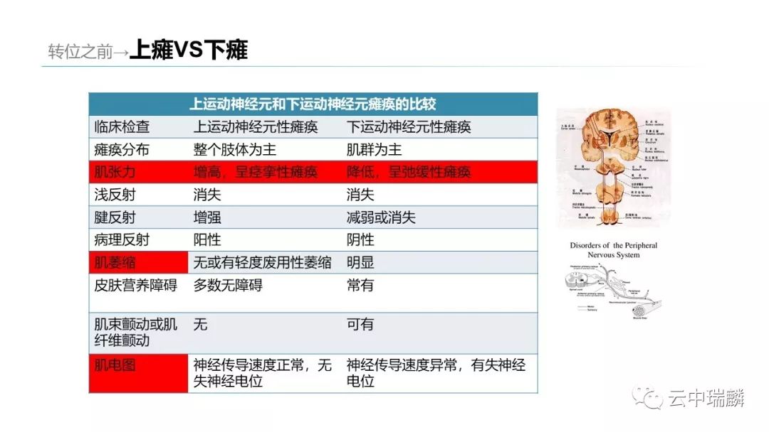 肌腱转位的原则及手术要点，详细解析！