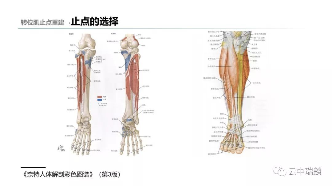 一文掌握：肌腱转位的原则及手术要点