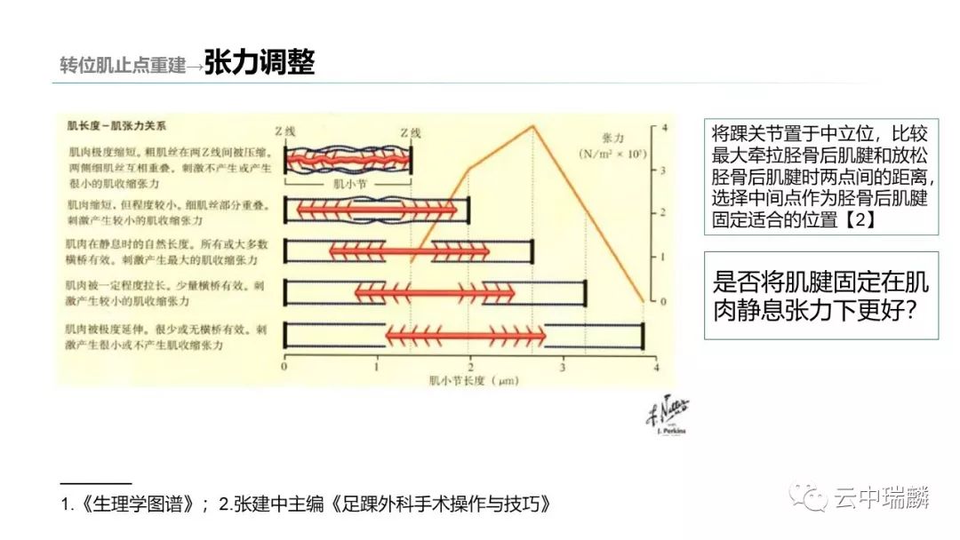 一文掌握：肌腱转位的原则及手术要点