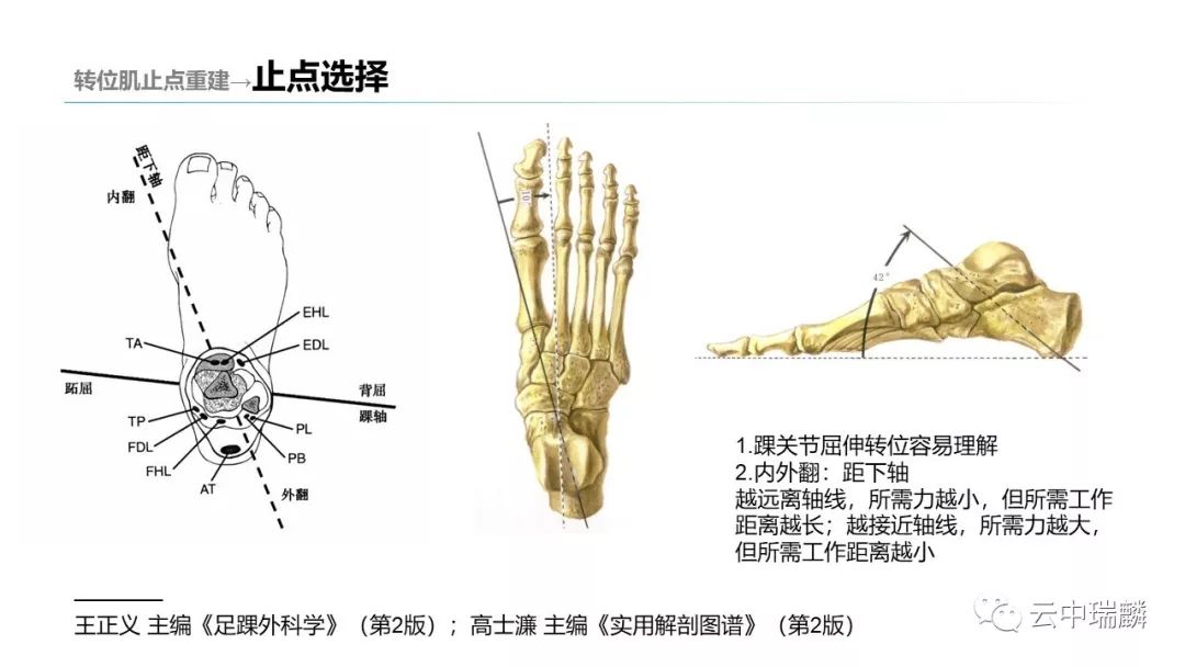 一文掌握：肌腱转位的原则及手术要点