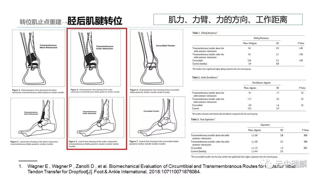 一文掌握：肌腱转位的原则及手术要点