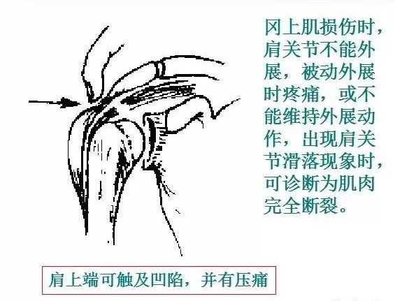 90%的运动损伤检查法，都在这里！