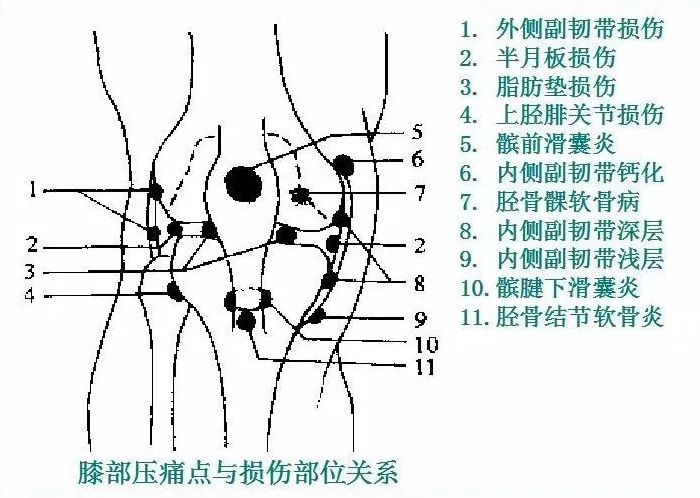 90%的运动损伤检查法，都在这里！