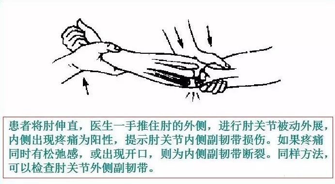 90%的运动损伤检查法，都在这里！