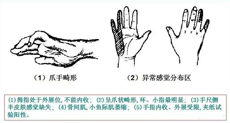 90%的运动损伤检查法，都在这里！