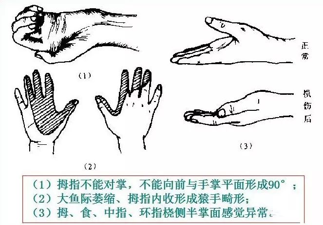 90%的运动损伤检查法，都在这里！