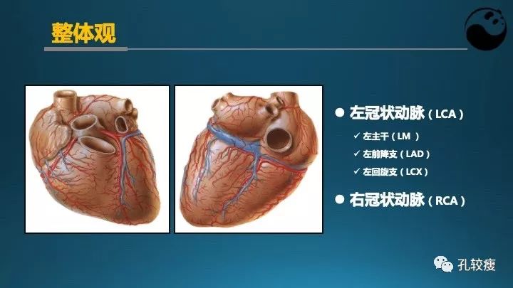 步步为营掌握冠状动脉造影【一】：解剖-体位-安全法则