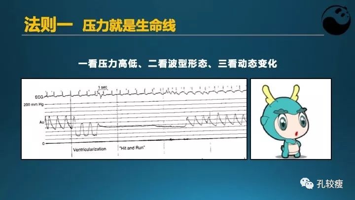 步步为营掌握冠状动脉造影【一】：解剖-体位-安全法则