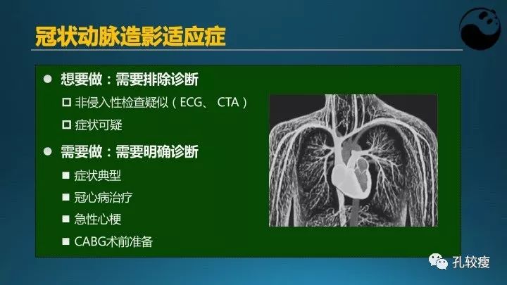 步步为营掌握冠状动脉造影【一】：解剖-体位-安全法则