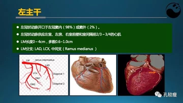 步步为营掌握冠状动脉造影【一】：解剖-体位-安全法则