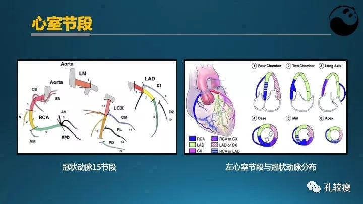 步步为营掌握冠状动脉造影【一】：解剖-体位-安全法则